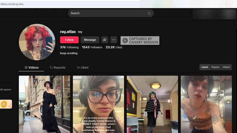 Ray Atlas cm05 TikTok_#7